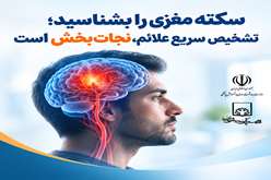 سکته مغزی را بشناسید؛ تشخیص سریع علائم، نجات‌بخش است